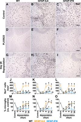 Microglia shield the murine brain from damage mediated by the cytokines IL-6 and IFN-α